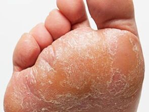 Foot mushroom