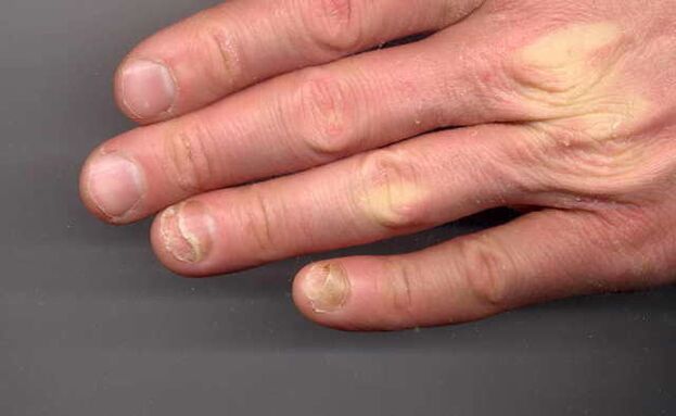 So on your hands