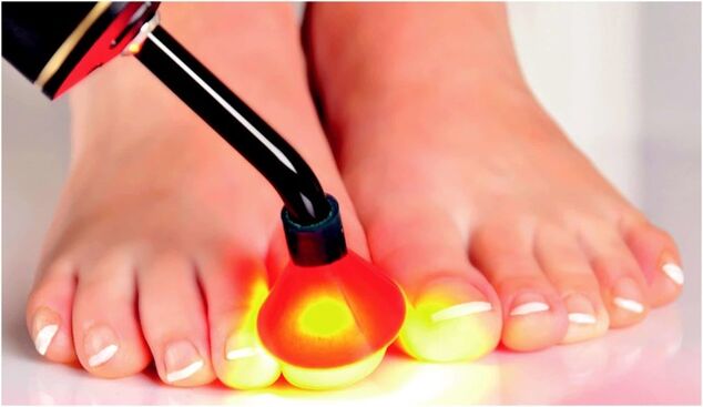 Treatment by radiation