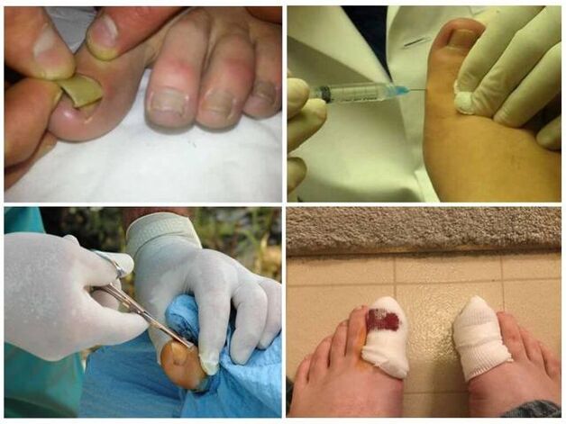 surgery